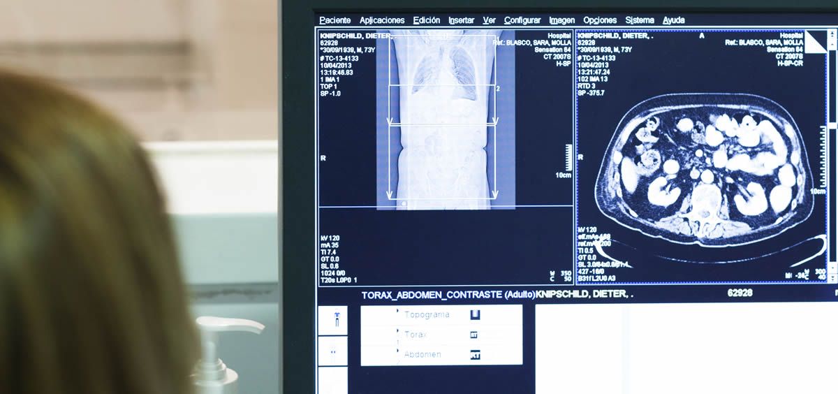 Pacientes del Departamento de Salud de Dénia pueden consultar ya sus imágenes radiológicas (Foto. ConSalud)