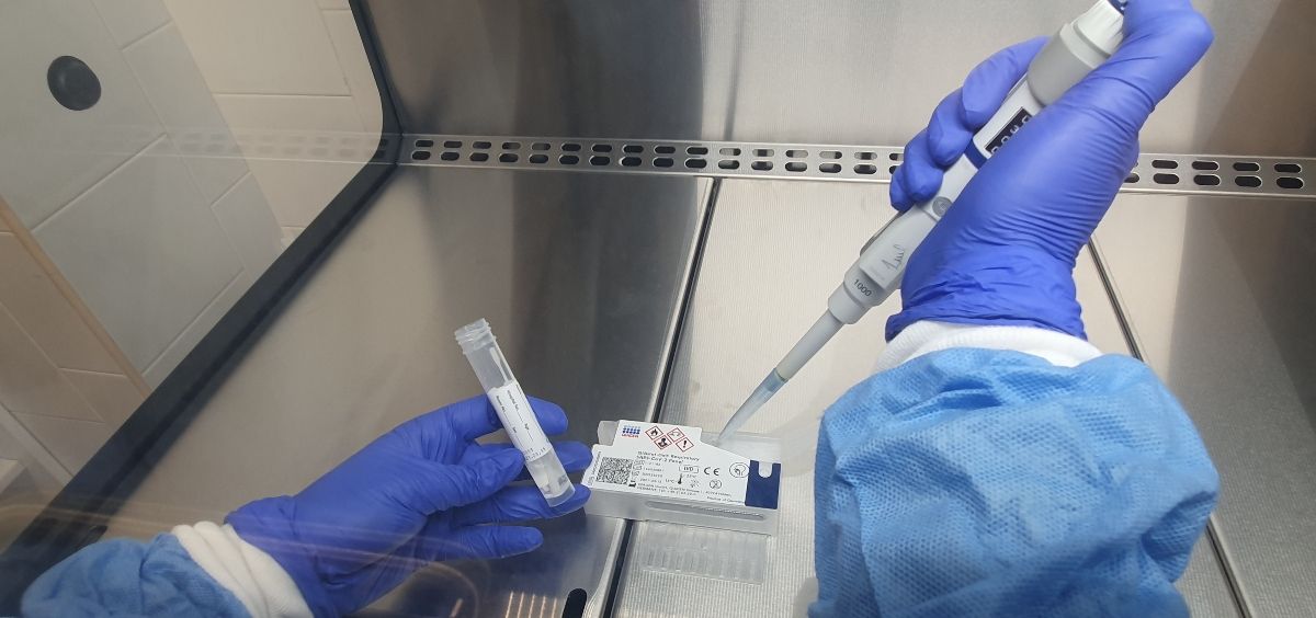 PCR de saliva (Foto. Policlínica Nuestra Señora del Rosario)