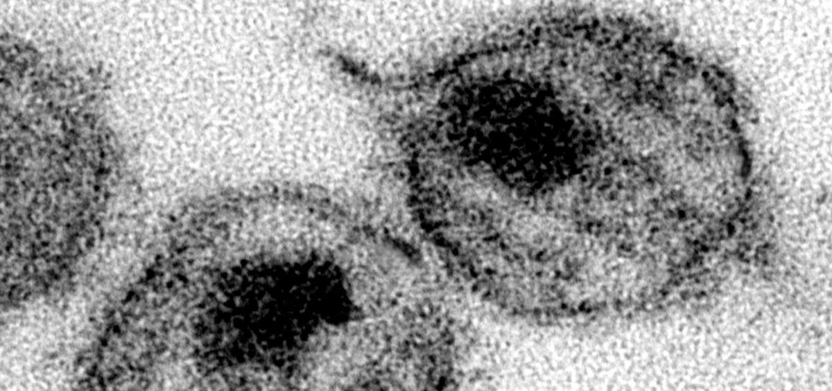 Virus del VIH (imagen de A. Harrison y P. Feorino, del USCDCP, vía PIxnio). (Foto. PIXNIO   Archivo)