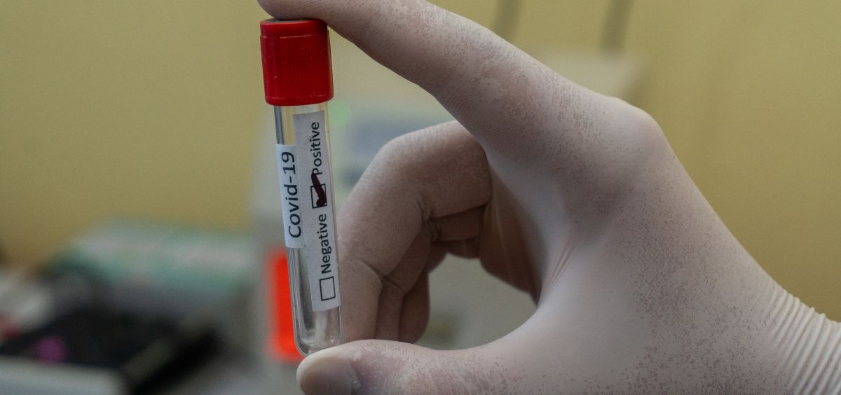 Muestra para test de coronavirus covid 19. (Foto. Unsplash)