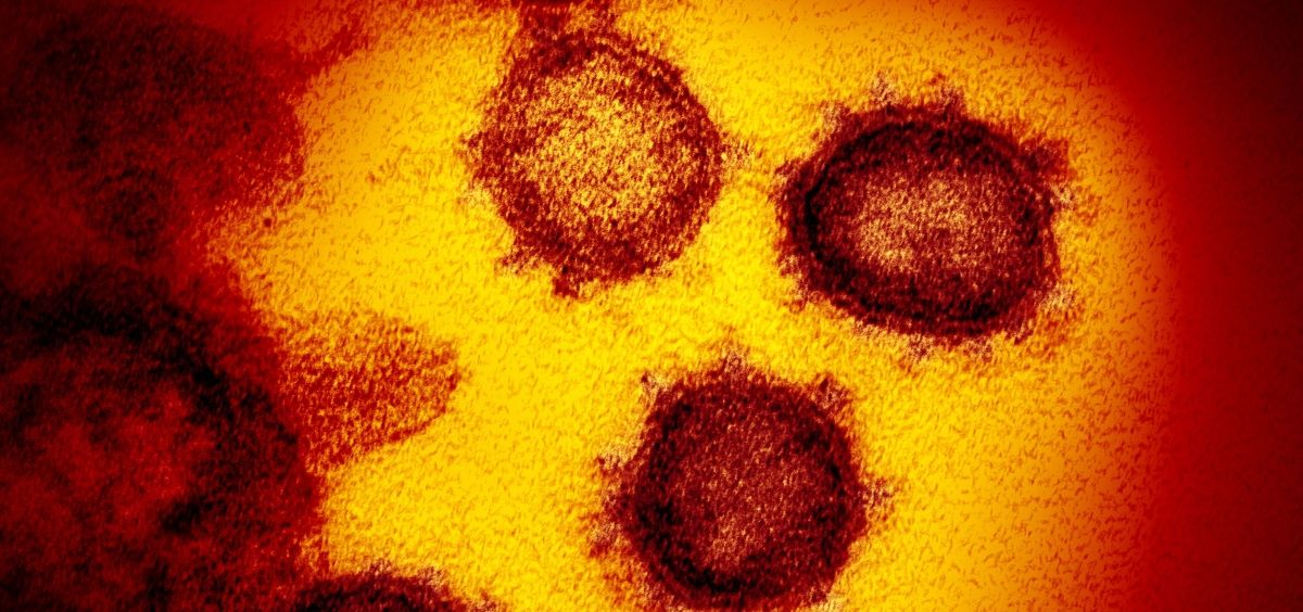 Micrografía electrónica que muestra coronavirus SARS CoV 2