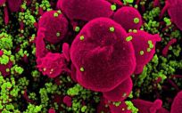Micrografía electrónica de barrido coloreada de una célula apoptótica (rosa) muy infectada con partículas del virus SARS-CoV-2 (verde), aislada de una muestra de un paciente (Foto. National Institute of Allergy and Infectious Diseases/EP)