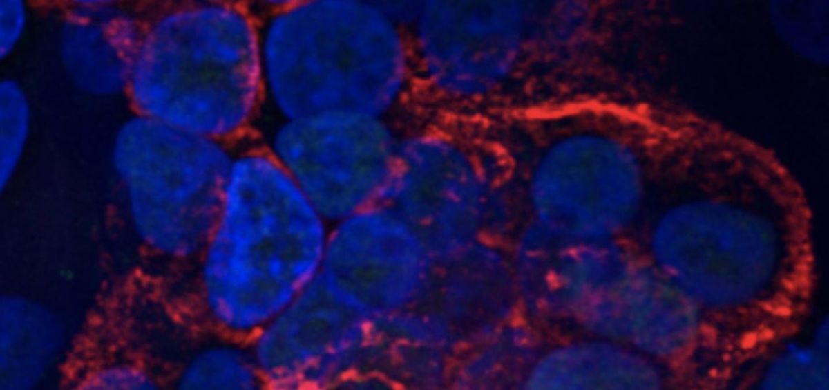 Células de pulmón humano (azul) infectadas con SARS CoV 2 (rojo). Foto de Hekman, et al.