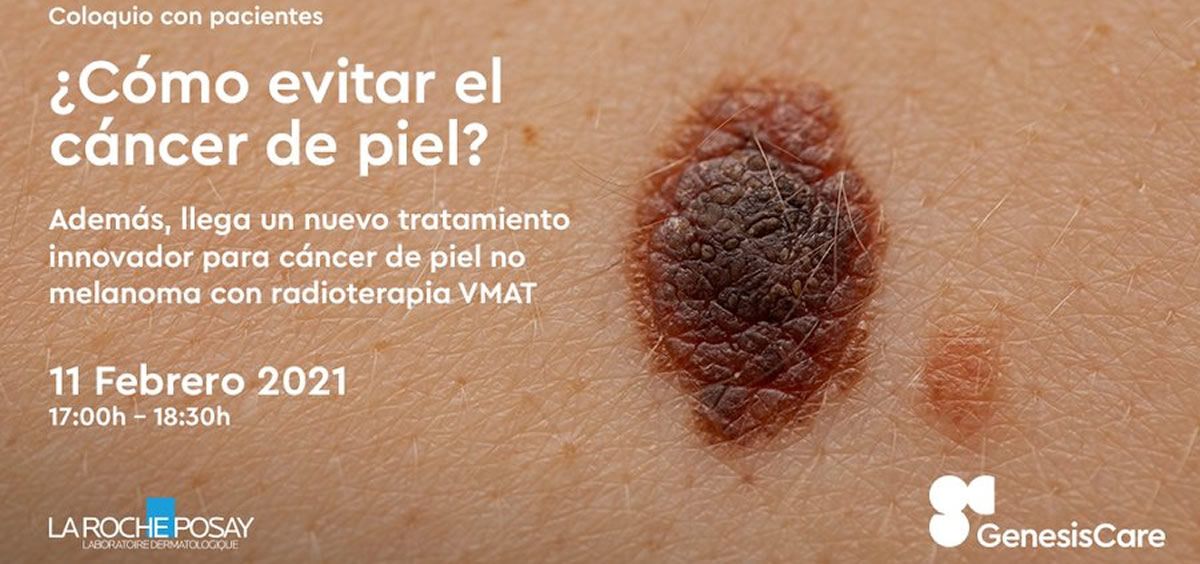 GenesisCare presenta un tratamiento innovador para cáncer de piel no melanoma con radioterapia VMAT