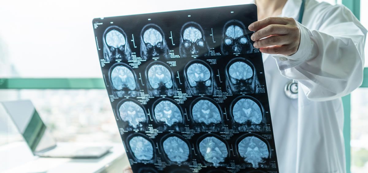 Un diagnóstico tardío de las encefalitis desemboca en secuelas neurológicas graves