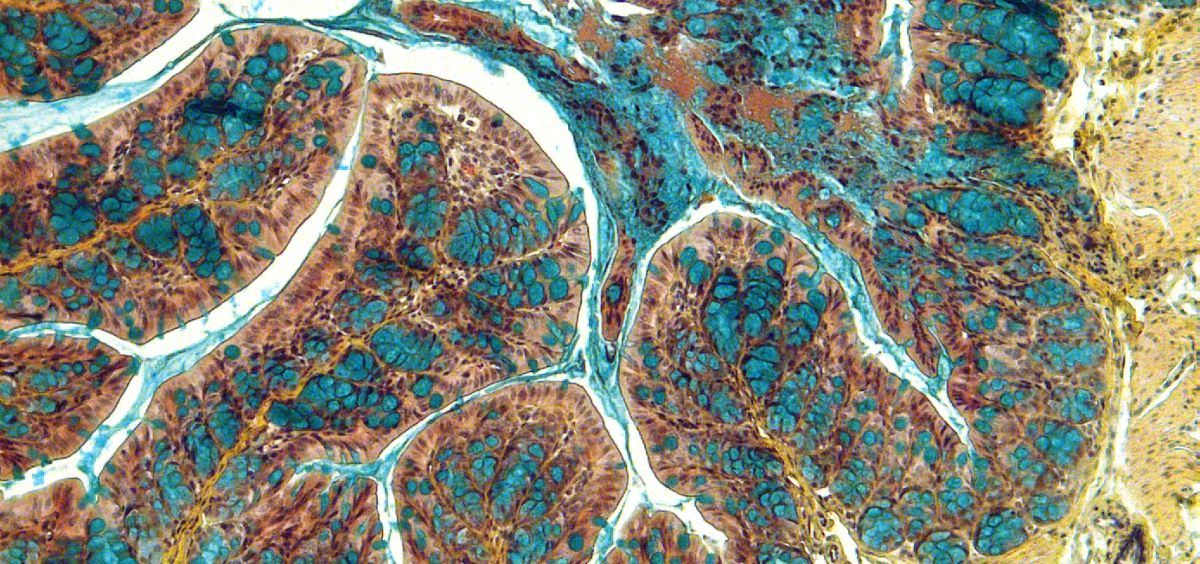 Imagen de un corte del intestino de un ratón afectado con enfermedad inflamatoria intestinal (CSIC)