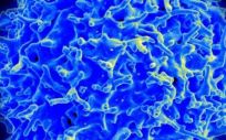 Micrografía electrónica de barrido de un linfocito T humano (también llamado célula T) del sistema inmunológico de un donante sano. (Foto. NAID)