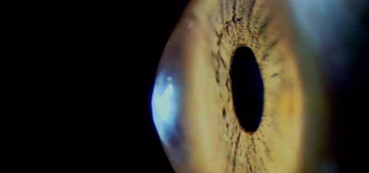 Escáner robótico automatiza las imágenes de diagnóstico en el ojo (Foto. VIOBIO LAB CSIC  )