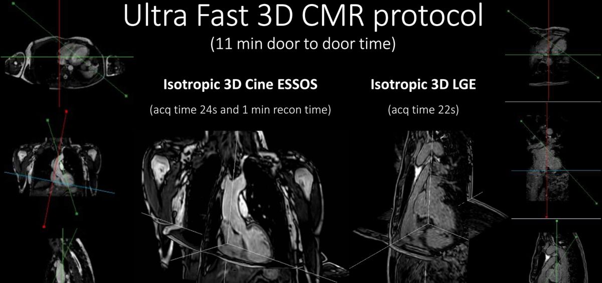 Ultra Fast 3C CMR protocol (Foto. CNIC)