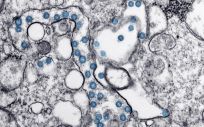 Partículas del virus SARS CoV 2, coloreadas en azul, en una imagen de microscopio de electrones.  (Foto. CDC)