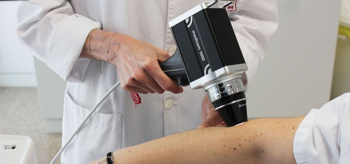 El Hospital del Vinalopó incorpora un equipo de mapeo corporal automatizado a Dermatología (Foto. Ribera)