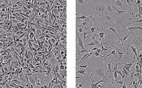 Las células de cáncer de mama triple negativas se muestran a la izquierda. Sin la proteína de unión al ARN YTHDF2 (drcha), sobrevivieron menos células cancerosas (Foto: UC SAN DIEGO HEALTH SCIENCES)