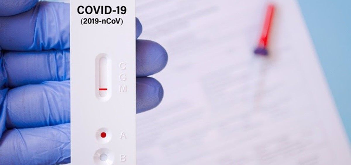 Test de autodiagnóstico de Covid-19. (Foto: Consejo General de Colegios Farmacéuticos / Europa Press)