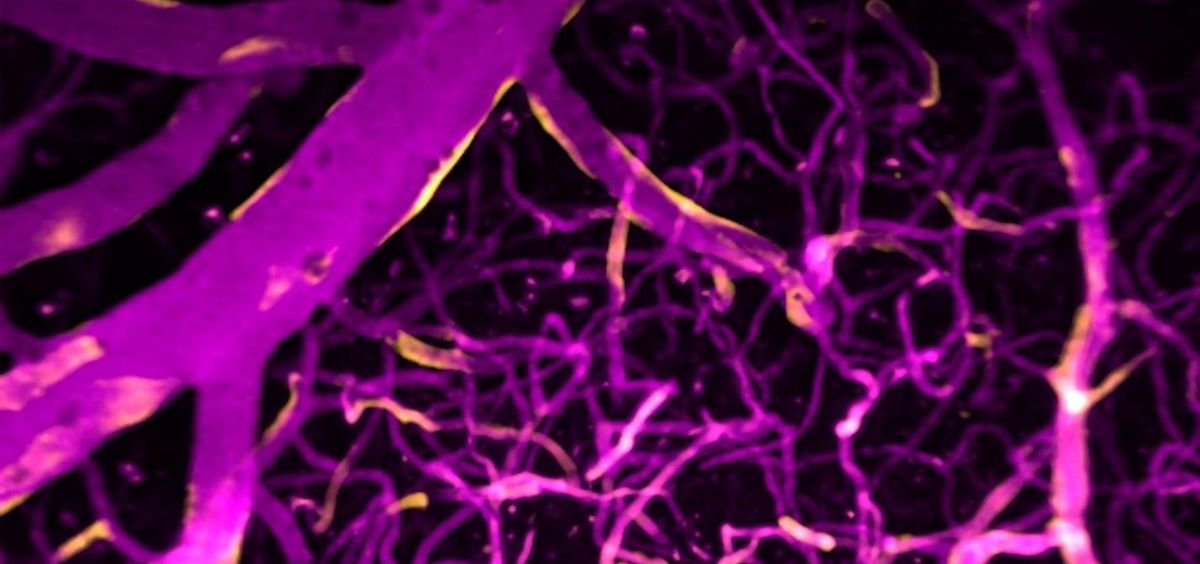 El calcio (rosa) dirige el flujo sanguíneo en los vasos sanguíneos del cerebro. (Foto. Thomas Longden)