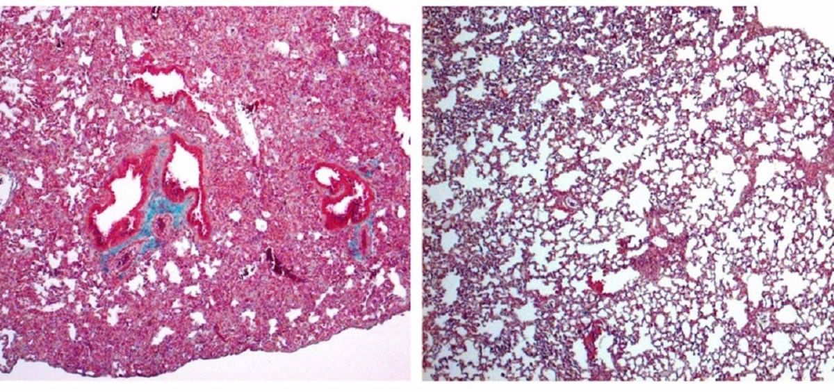 A la izquierda, pulmón de ratón con signos de fibrosis pulmonar grave. A la derecha, pulmón de ratón tratado con cortistatina, en el que el daño es mucho menor (Foto: IPBLN-CSIC)