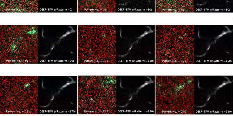 Imágenes con la microscopia de dos fotones modificada de la vasculatura cortical (Foto. MIT)