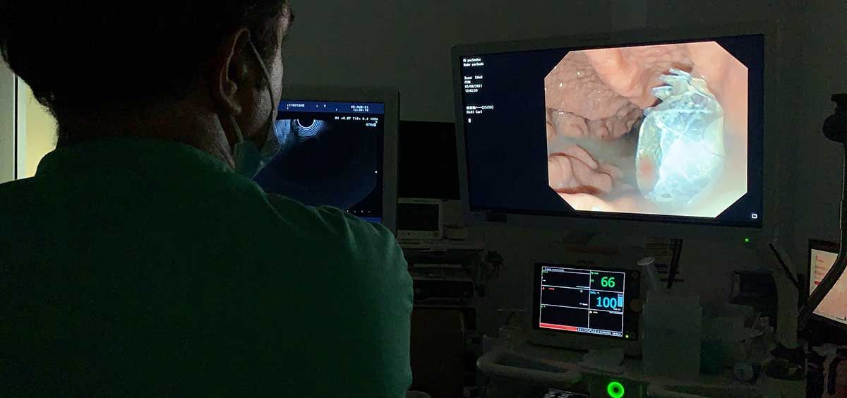 El Hospital del Vinalopó implanta una prótesis para tratar las complicaciones por pancreatistis aguda (Foto. Grupo Ribera)