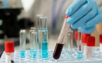 Científico analizando muestras de sangre en un laboratorio