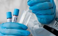 Profesional de laboratorio analizando muestras de sangre de pacientes COVID 19