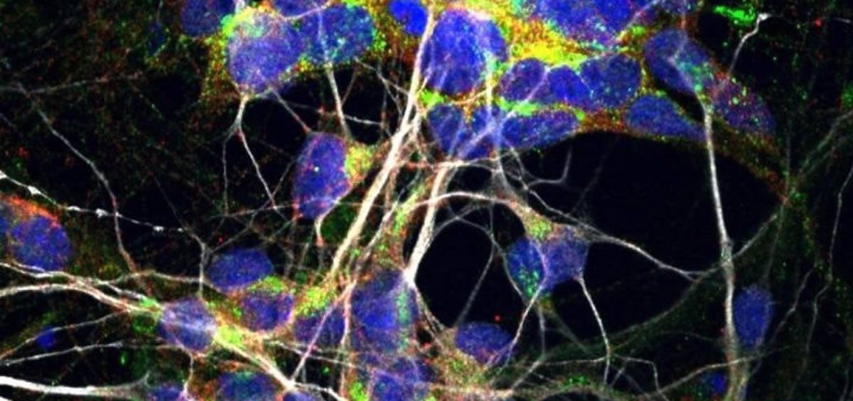 Células nerviosas motoras (Foto: Justin Ichida Lab/USC STEM CELL)