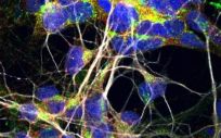 Células nerviosas motoras (Foto: Justin Ichida Lab/USC STEM CELL)