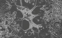 Un estudio del CSIC muestra que el herpes genital evoluciona más rápido que el labial (Foto. CSIC)
