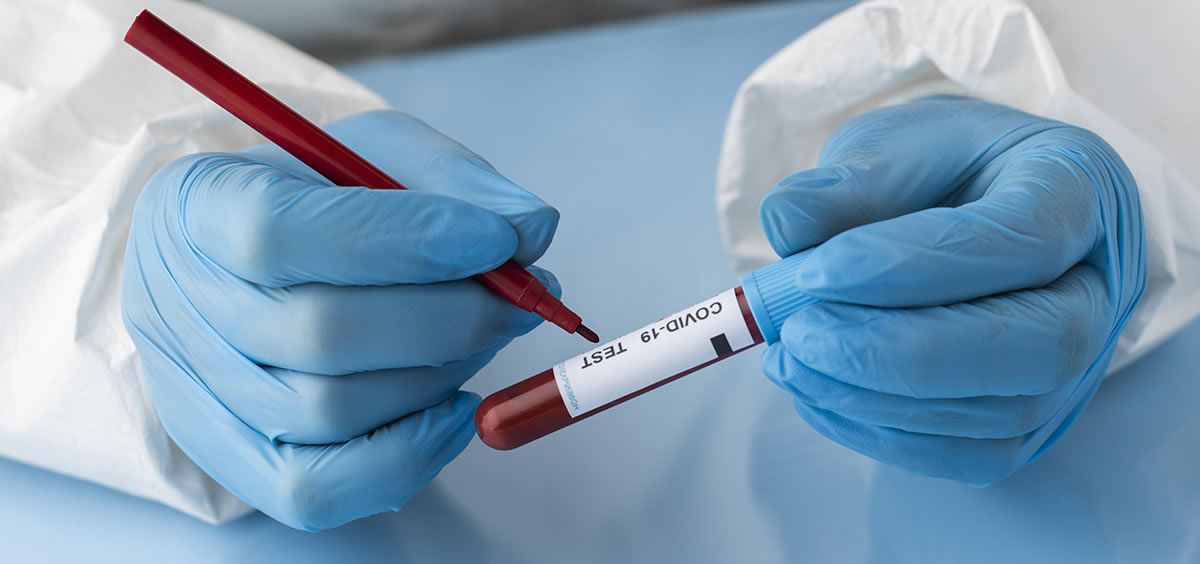 Profesional sanitario identificando una muestra de sangre de un paciente con COVD 19 (Foto. Freepik)