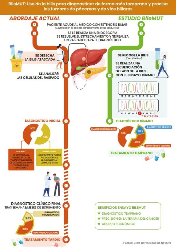 Infografía sobre el diagnóstico de tumores biliares. (Foto. Ciber)