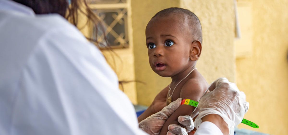 Control médico para evaluar el estado nutricional de un niño en Chad (Foto. UNICEF / UN0126852 / Dicko)