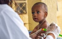 Control médico para evaluar el estado nutricional de un niño en Chad (Foto. UNICEF / UN0126852 / Dicko)