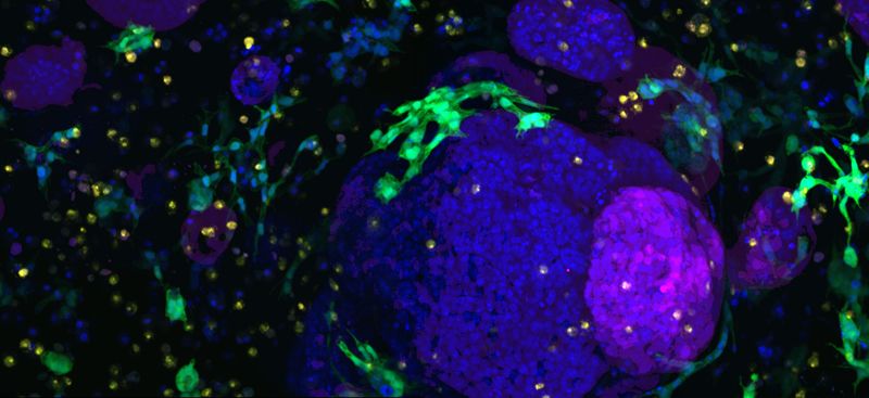 Los investigadores también pudieron usar su sistema para hacer crecer células de apoyo como fibroblastos (verde) y macrófagos (naranja) que rodean a los organoides pancreáticos. (Foto. Cortesái de lso investigadores)