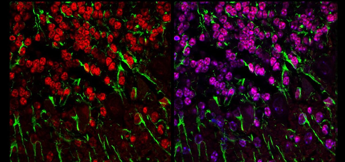 Corte histológico de cerebelo de ratón modelo de enfermedad mitocondrial con neuronas granulares marcadas en rojo y prolongaciones gliales en verde (Foto: María Morán)