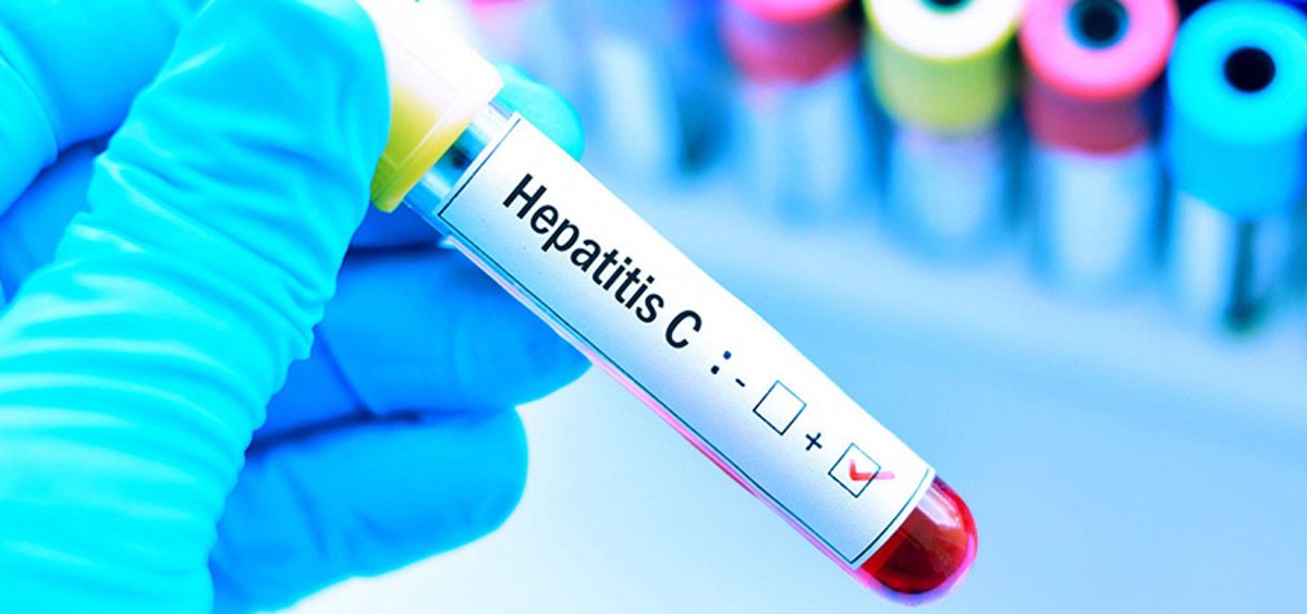 Hepatitis C. (Foto. Freepik)