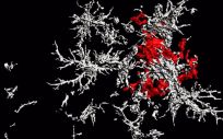 Una placa de beta amiloide de núcleo denso (rojo) rodeada de microglía que carece de receptores TAM (blanco) en el cerebro de un ratón con enfermedad de Alzheimer (Foto: Salk Institute)