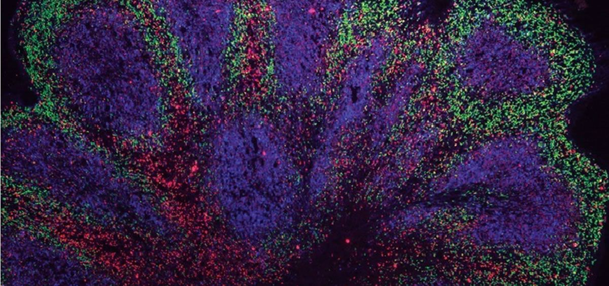 Mini organoides cerebrales muestran estructuras parecidas a la corteza.   ANDRAS LAKATOS. UNIVERSITY OF CAMBRIDGE   EUROPA PRESS