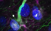 Célula madre en el hipocampo humano adulto (Foto: CBMSO-CSIC-UAM)
