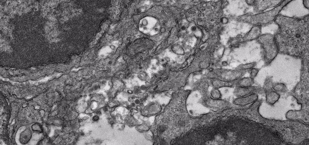 Imagen de microscopía electrónica del tejido de un ganglio linfático de un ratón que fue inmunizado con esta vacuna experimental contra la Covid-19 (Foto: Yi-Nan Zhang)
