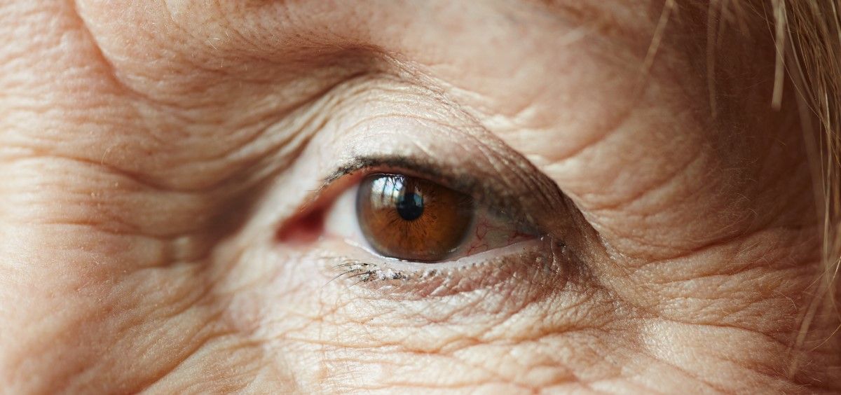 Degeneración macular asociada a la edad, DMAE. (Foto. Freepik)