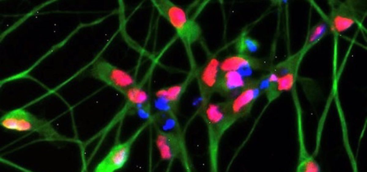 Neuronas en las que se ha estudiado el cambio el metabolismo en pacientes con ELA (Foto. Cortesía del investigador)