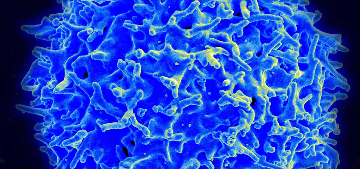 Imagen de micrografía de un linfocito T humano del sistema inmunitario (Foto. NIAID CSIC)