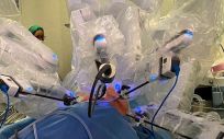 Bellvitge realiza por primera vez en el mundo una exéresis mediante una sola incisión y a través de cirugía robótica. (Foto. Bellvitge)
