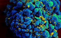 Electromicrografía de barrido de una célula T H9 infectada por el VIH (Foto. NIAD)