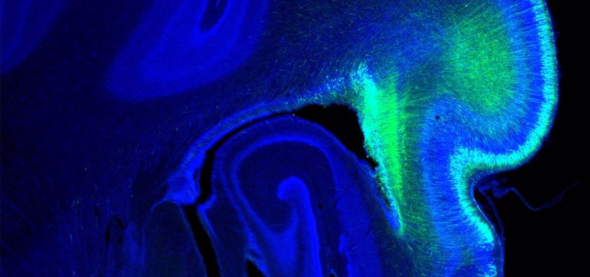Imagen del cerebro de un hurón (Foto. CSIC UMH) 