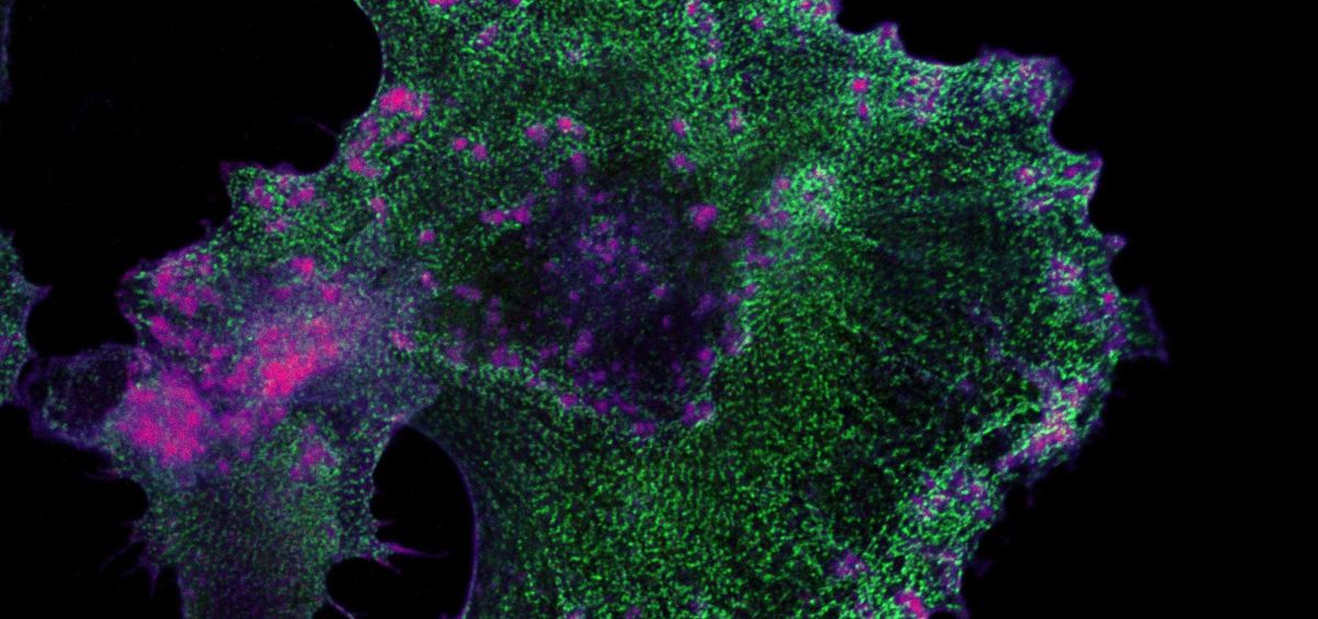 Célula innata del sistema inmune que detecta antígenos tumorales. (Foto. Miguel Vicente CIC. CSIC USAL)