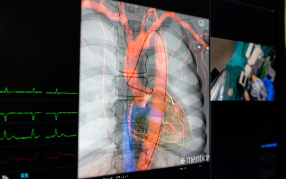 Sistema robotizado para la realización de procesos de cardiología intervencionista del Marañón(Foto. Hospital Gregorio Marañón)