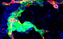 Imagen de la metástasis en cerebro de ratón. En verde, células tumorales que permanecen ‘escondidas’ después de una cirugía (Foto. CNIO)