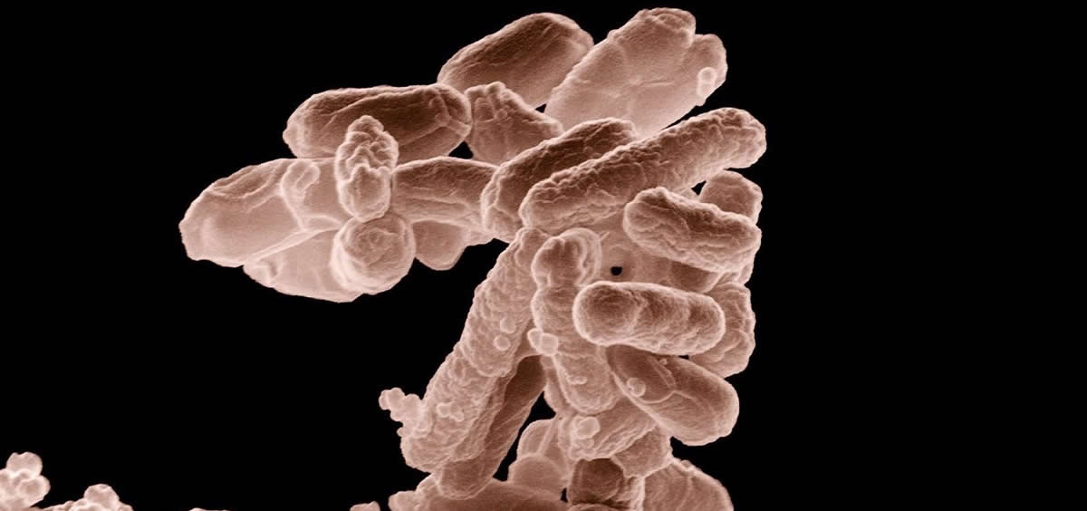 Imagen de microscopio de la bacteria Escherichia coli. (Foto: USDA)