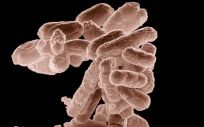 Imagen de microscopio de la bacteria Escherichia coli. (Foto. USDA)