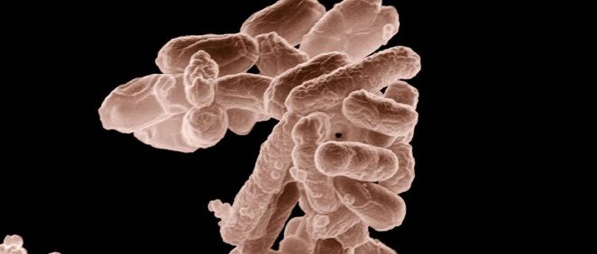 Imagen de microscopio de la bacteria Escherichia coli. (Foto: USDA)