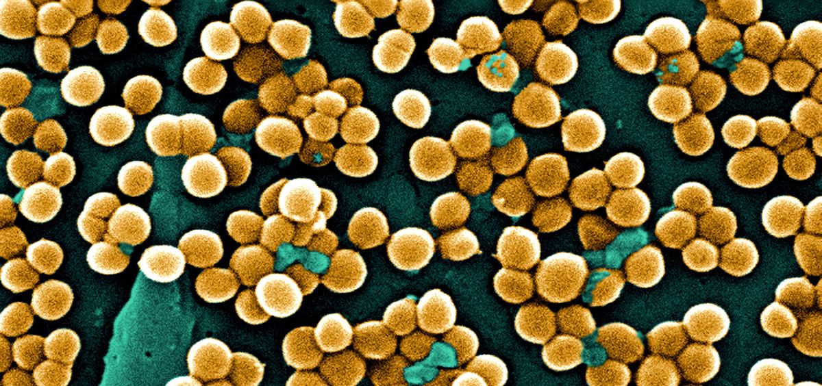 Vista de estafilococo dorado resistente a meticilina (Foto: CSIC)